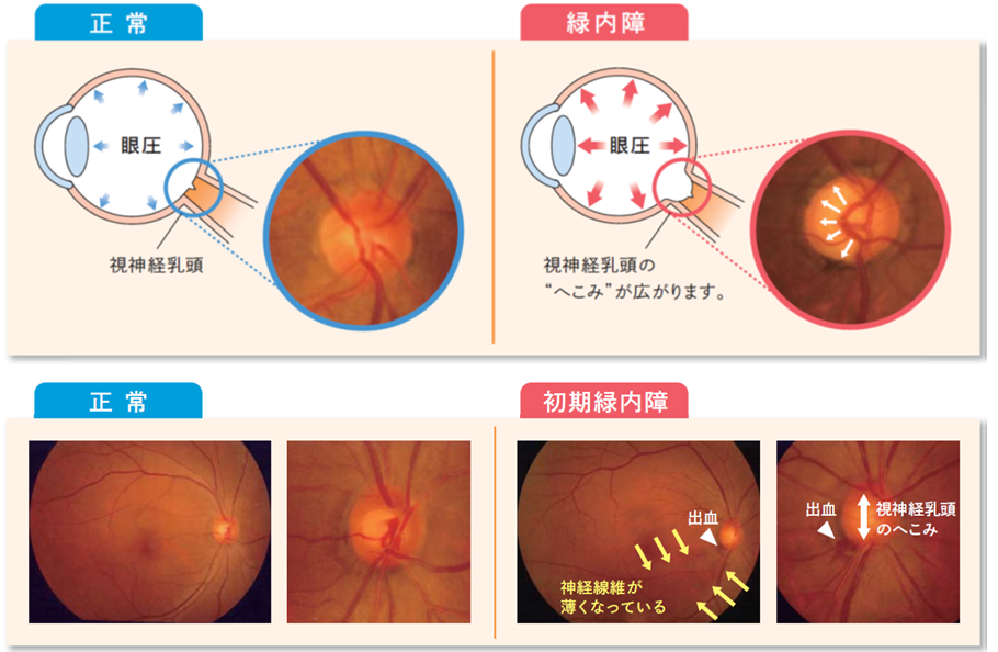 眼底検査（眼底カメラ）