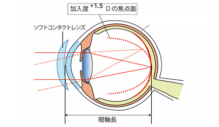 近視抑制のしくみ